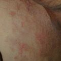 misuse_clobegen020812.jpg