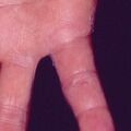 misuse_clobegen9-537.jpg