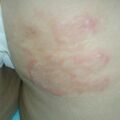 misuse_clobegena020725.jpg