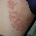 misuse_clobegena020814-1.jpg