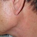 misuse_clobegena020817-1.jpg