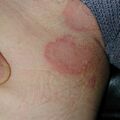 misuse_clobegena020817-4.jpg