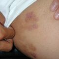 misuse_clobegena020817.jpg