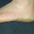 misuse_coldcream020216-1.jpg