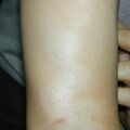 misuse_corzol020426.jpg
