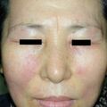 misuse_cosmetic_aloe020327.jpg
