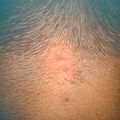 misuse_cresol9-295.jpg
