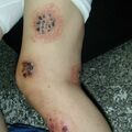 misuse_cupping010921-1.jpg