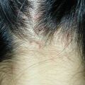 misuse_dendri020522-1.jpg