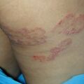 misuse_dendri020615.jpg