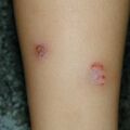 misuse_dermasone020729-1.jpg