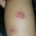 misuse_dermasone020819.jpg