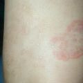 misuse_dermatop010611-1.jpg