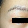 misuse_dermatop010628.jpg