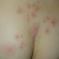 misuse_dermatop010704.jpg