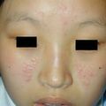 misuse_dermatop010710.jpg