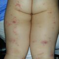 misuse_dermatop010726.jpg