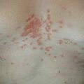 misuse_dermatop010820.jpg