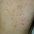 misuse_dermatop010910.jpg