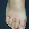misuse_dermatop010915-1.jpg