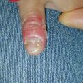 misuse_dermatop011110.jpg