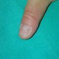 misuse_dermatop011224.jpg