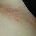 misuse_dermatop020612.jpg