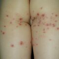 misuse_dermatop020708.jpg