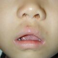misuse_dermatop020730-1.jpg