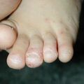 misuse_dermatop020826-2.jpg