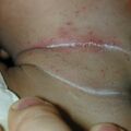 misuse_dermatop020902.jpg