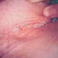 misuse_dermatop9-549.jpg