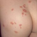 misuse_dermatop9-672.jpg