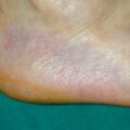misuse_dermocort010317-1.jpg