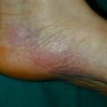 misuse_dermocort010317-2.jpg