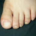 misuse_dermovate020422-1.jpg
