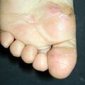 misuse_dermovate020422-2.jpg