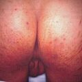 misuse_dermovate9-42.jpg
