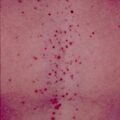 misuse_dermovate9-750.jpg