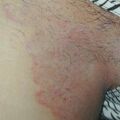 misuse_desowen010816.jpg