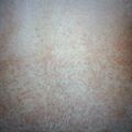 misuse_diflucan9-526.jpg