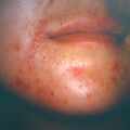 misuse_donacel9-693.jpg