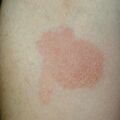 misuse_dyeacd010528-2.jpg