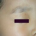 misuse_ecolicin020611.jpg