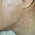 misuse_ecolong010620-1.jpg