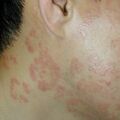misuse_ecolong010620-2.jpg