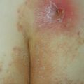 misuse_ecolong010709.jpg