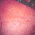 misuse_ecolong9-824.jpg
