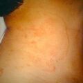 misuse_endixg9-417.jpg