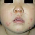 misuse_euvena020805.jpg